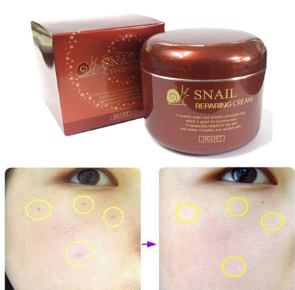 🐌 Jigott Snail Repairing Cream – 100g